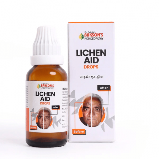 Lichen Aid Drops- 30 ML